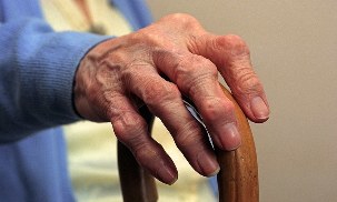 Артрит і артроз пальців рук у літньої людини